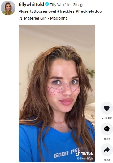 「DIYタトゥーはしないで！」と訴えるティリーさん（画像は『Tilly Whitfeld　2022年3月12日付TikTok「＃lasertattooremoval」』のスクリーンショット）