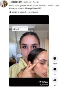 腫れが引いた後、向かって右側の眉が下がってしまったジェシーさん（画像は『_jessiecarr　2022年3月4日付TikTok「Reply to ＠_jessiecarr FOXEYE THREAD STORYTIME Part 2」』のスクリーンショット）