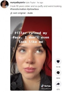 輪郭まで変わってしまったカイリーさん（画像は『Kylie Taylor　2022年3月14日付TikTok「I look 10 years older and so puffy and weird looking.」』のスクリーンショット）