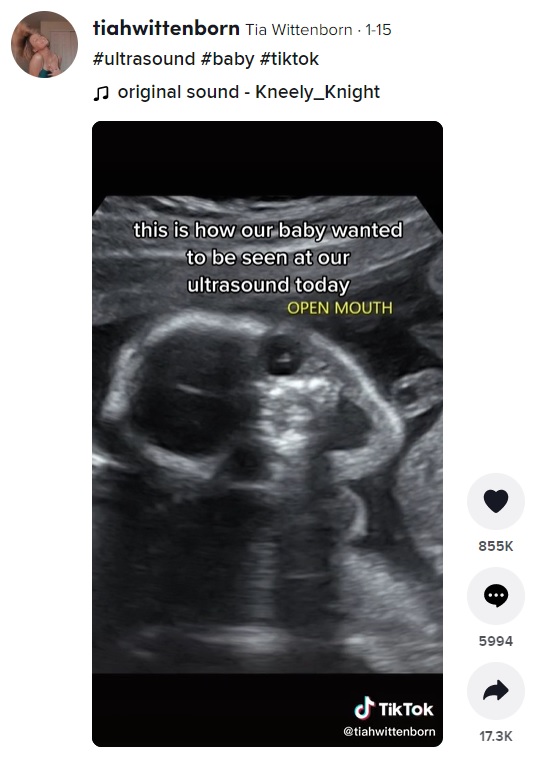 とびきりの笑顔を見せる我が子の姿が（画像は『Tia Wittenborn　2022年1月15日付TikTok「＃ultrasound ＃baby ＃tiktok」』のスクリーンショット）