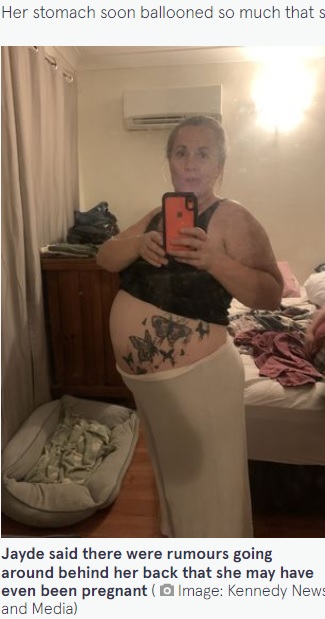 スイカのようなお腹（画像は『The Mirror　2022年4月21日付「Mum who dismissed swollen tummy as weight gain had watermelon-sized ovarian cyst」（Image: Kennedy News and Media）』のスクリーンショット）