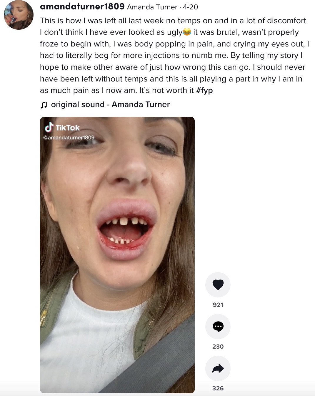 「こんなことになるなんて信じられない」とアマンダさん（画像は『Amanda Turner　2022年4月20日付TikTok「This is how I was left all last week no temps on and in a lot of discomfort」』のスクリーンショット）