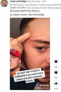 シャワーの後、膿が出てきたというライアンさん（画像は『Ryan Ruckledge　2022年4月26日付TikTok「Do NOT get fox eye threads.」』のスクリーンショット）