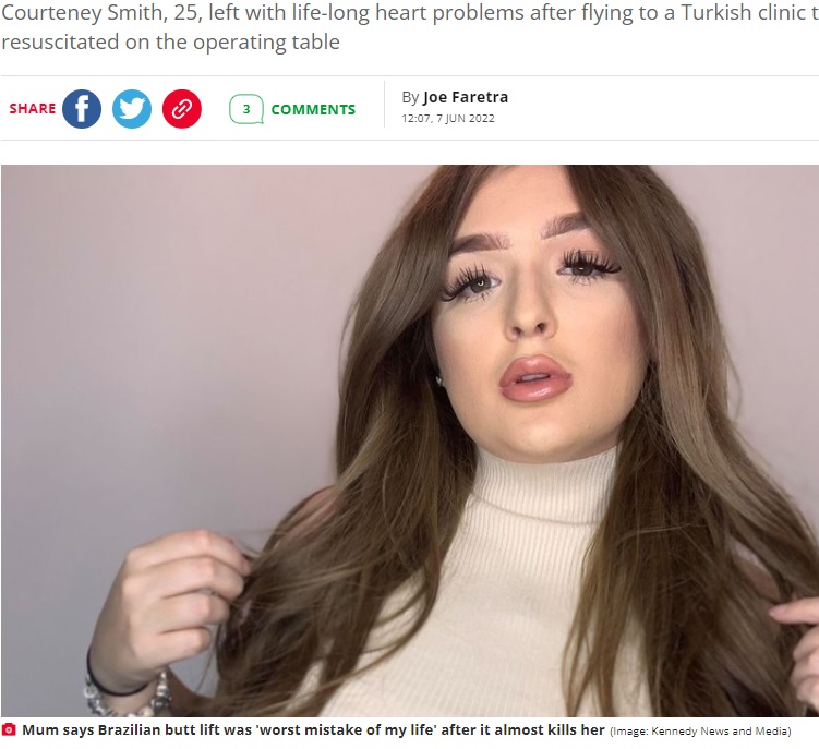 トルコで豊尻手術を受けた女性（画像は『The Daily Star　2022年6月7日付「Mum says Brazilian butt lift was ‘worst mistake of my life’ after it almost kills her」（Image: Kennedy News and Media）』のスクリーンショット）