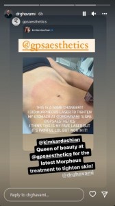 キムのお腹にレーザーを照射している様子（画像は『Ashkan Ghavami MD　2022年8月4日付Instagram』のスクリーンショット）