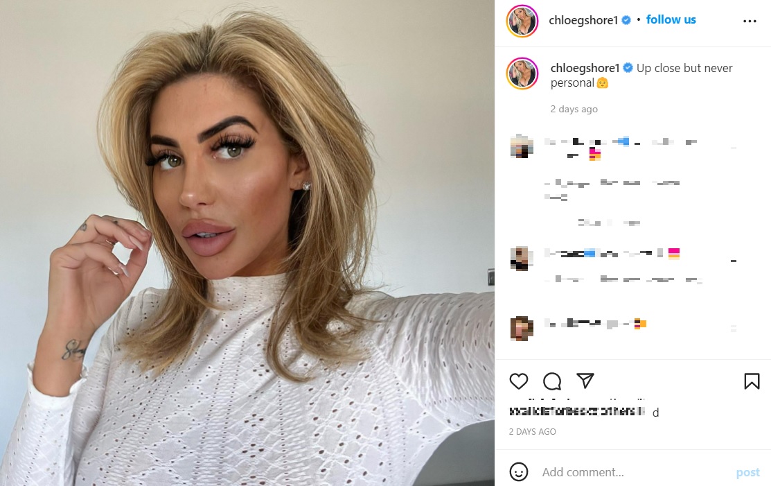 「フォックスアイ・スレッドリフト」を受けて後悔しているクロエさん（画像は『Chloe Ferry　2022年8月4日付Instagram「Up close but never personal」』のスクリーンショット）