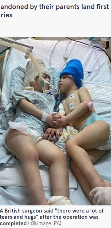 手術後初めて向き合い手を繋いだ2人（画像は『The Mirror　2022年8月1日付「Conjoined twins successfully separated after 27 hours of ‘space age’ surgery」（Image: PA）』のスクリーンショット）