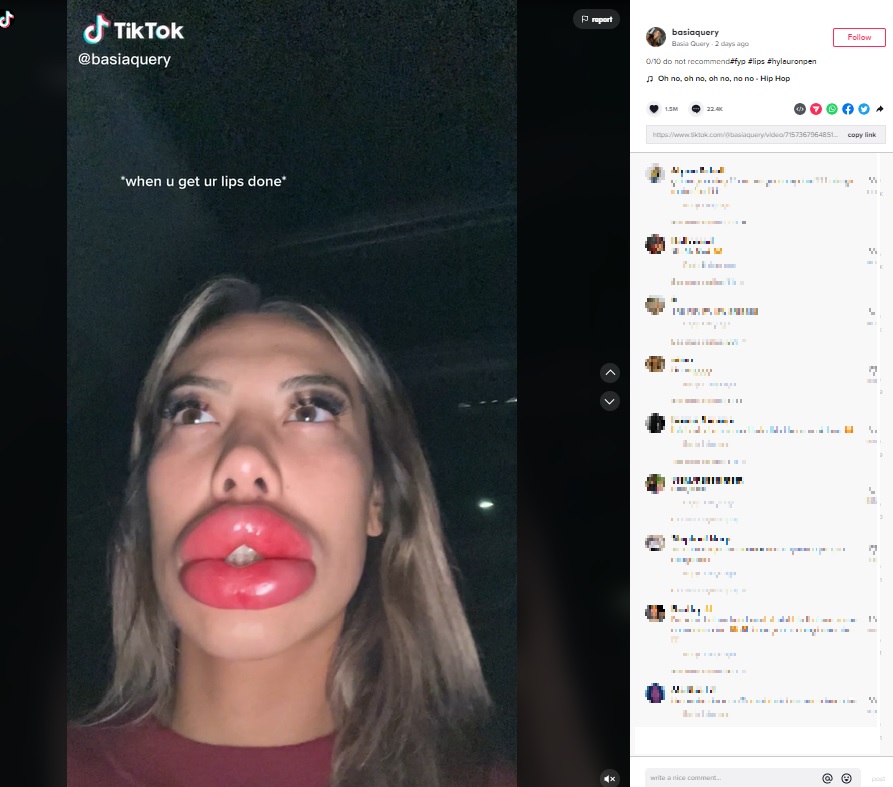 赤い生ソーセージと化した唇（画像は『Basia Query　2022年10月23日付TikTok「0/10 do not recommend」』のスクリーンショット）