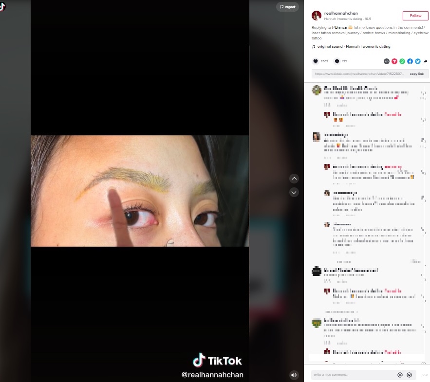 3度目のレーザー治療後、黄（緑）色に（画像は『Hannah | women’s dating　2022年10月9日付TikTok「Replying to ＠Bianca」』のスクリーンショット）