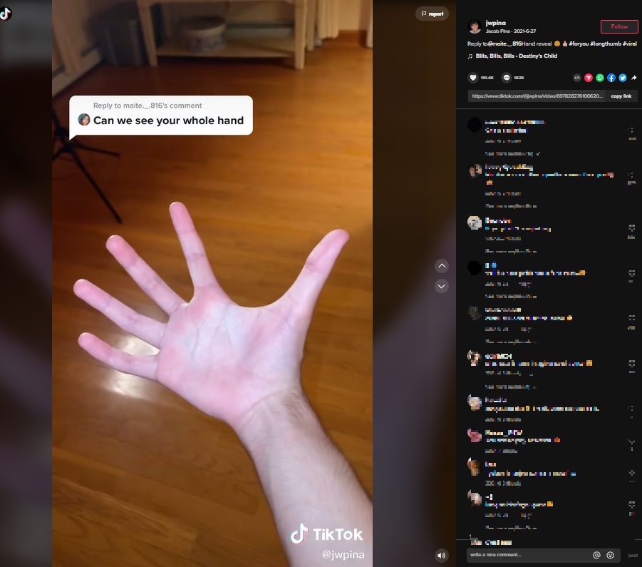 手を広げてみせるジェイコブさん（画像は『Jacob Pina　2021年6月27日付TikTok「Reply to ＠maite._.816 Hand reveal」』のスクリーンショット）