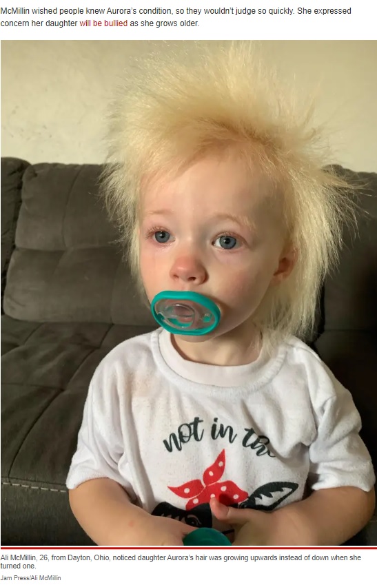 櫛でとかせない頭髪症候群のオーロラちゃん（画像は『New York Post　2022年12月3日付「My tot has Albert Einstein hair ― trolls call me irresponsible for not taming it」（Jam Press/Ali McMillin）』のスクリーンショット）