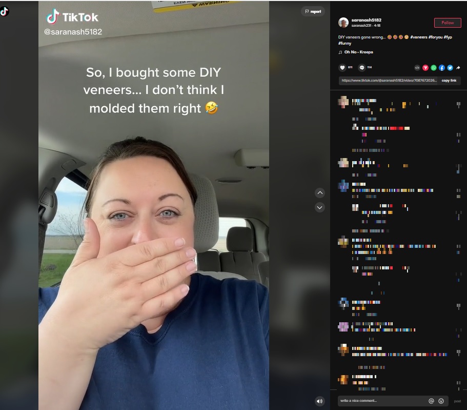 DIYのべニアの結果はいかに？（画像は『saranash231　2022年4月18日付TikTok「DIY vaneers gone wrong…」』のスクリーンショット）
