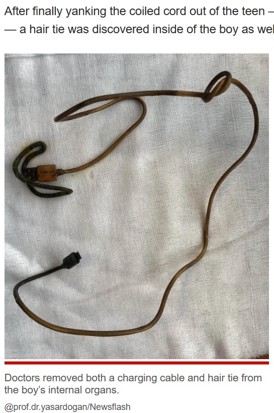 黒く変色していたUSBケーブル（画像は『New York Post　2022年12月16日付「I had agonizing stomach pain —my headphone charging cable was to blame」（＠prof.dr.yasardogan/Newsflash）』のスクリーンショット）