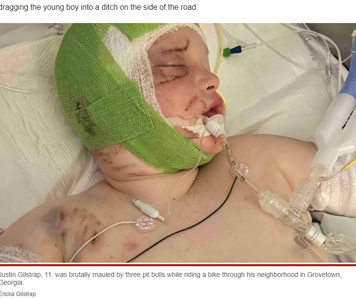 今後も手術が予定されているジャスティン君（画像は『New York Post　2023年1月10日付「Georgia boy severely injured after being pulled off bike, attacked by pit bulls」（Ericka Gilstrap）』のスクリーンショット）