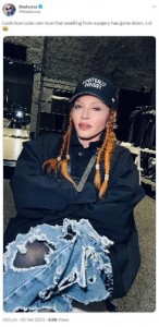 「腫れが引いて可愛くなったわ」とマドンナ（画像は『Madonna 2023年2月20日付Twitter「Look how cute i am now that swelling from surgery has gone down.」』のスクリーンショット）