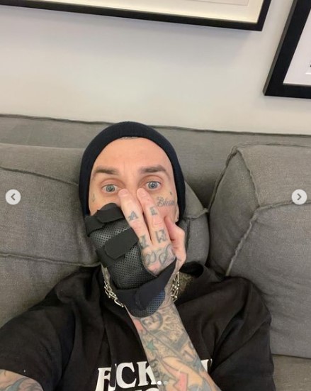 ドラム演奏中に左手指を負傷したトラヴィス・バーカー（画像は『travisbarker　2023年2月27日付Instagram「Surgery tomorrow」』のスクリーンショット）