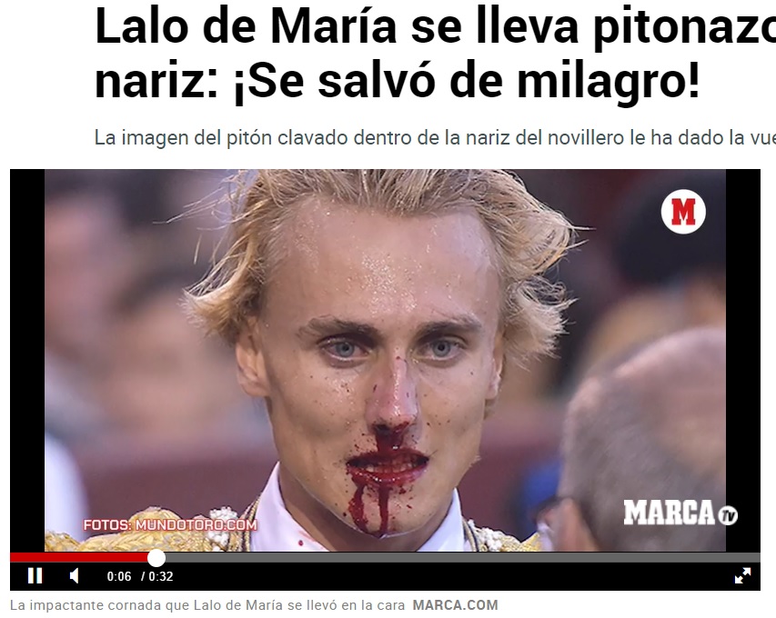鼻から大量に出血した闘牛士ラロ・デ・マリアさん。致命的な傷を負わずに済んだことに、SNS上で「奇跡だ」といった声があがる（画像は『MARCA　2023年5月30日付「Lalo de María se lleva pitonazo en la nariz: ¡Se salvó de milagro!」（MARCA.COM）』のスクリーンショット）