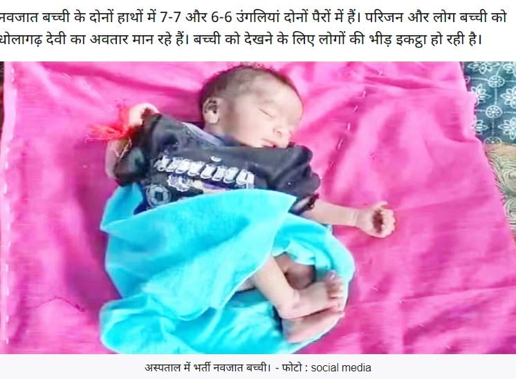 インド北西部ラージャスターン州ディーグで今月17日、手足指が全部で26本ある女児が誕生。家族はヒンドゥー教の女神の生まれ変わりと信じているという（画像は『Amar Ujala　2023年9月17日付「Rajasthan: डीग में जन्म के बाद नवजात बच्ची को देखने उमड़े लोग; मान रहे धोलागढ़ देवी का अवतार, ये है वजह」（फोटो : social media）』のスクリーンショット）