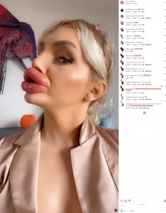 フォロワーからは「あなたの唇が大好き」「もっともっと大きくして！」「なんてセクシーなのかしら！」とヴィエナさんをサポートするコメントが寄せられているという（画像は『Vienna　2023年10月18日付Instagram』のスクリーンショット）