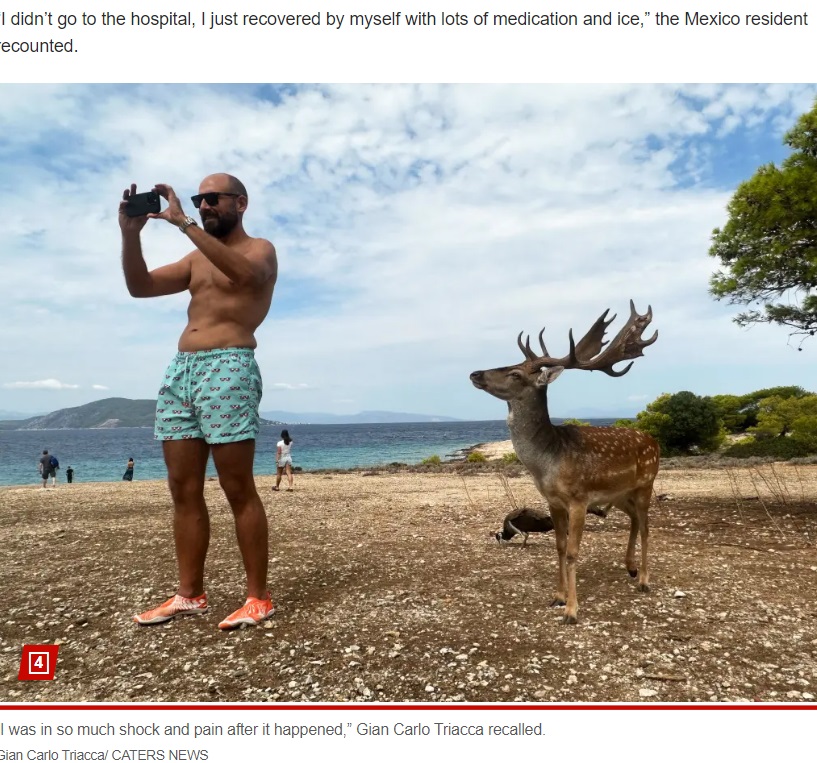 ギリシャで休暇中の男性は最近、写真撮影中に雄ジカに背後から角で突かれ酷い痛みを訴えた（画像は『New York Post　2023年11月3日付「I tried to take a selfie with a deer in the wild — I ended up with multiple broken ribs 」（Gian Carlo Triacca/ CATERS NEWS）』のスクリーンショット）