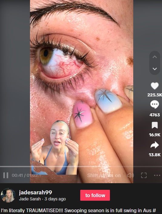 事故後の目の写真を添え、「真っ赤に充血しているし、不快感があるの。本当に目を失うところだったわ」と語ったサラさん（画像は『Jade Sarah　2023年11月21日付TikTok「I’m literally TRAUMATISED!!!」』のスクリーンショット）