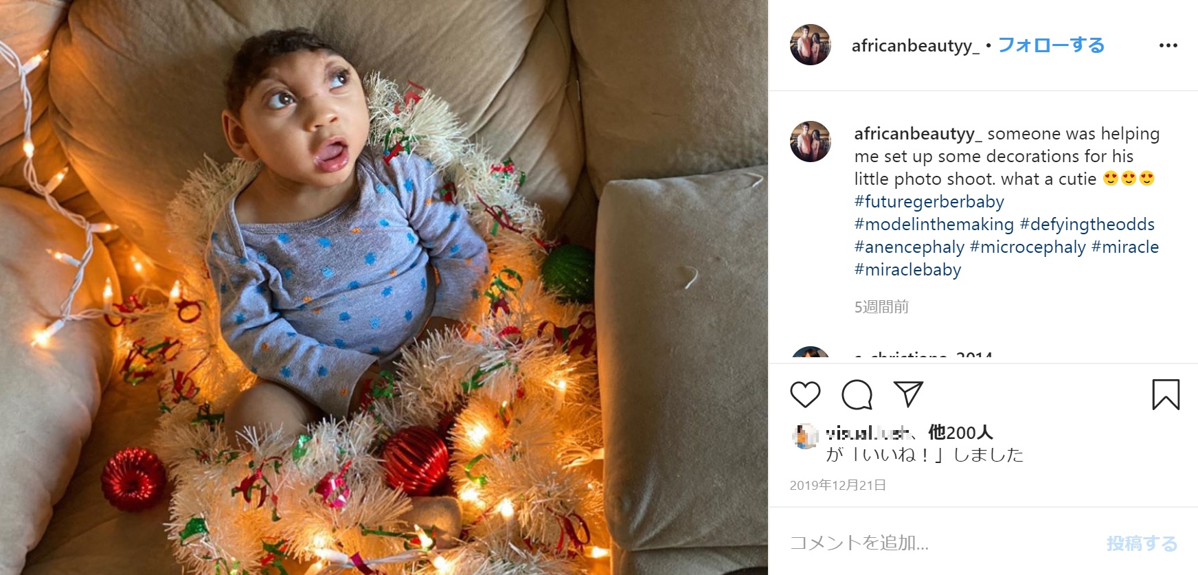 米テキサス州で、脳がはみ出た状態で産まれた男児。母親は妊娠中に「誕生しても長くは生きられないだろう」と医師に言われたものの、「絶対に生き抜く」と信じて出産した。2019年12月に1歳2か月を迎えていた（画像は『Moby Gordon　2019年12月21日付Instagram「someone was helping me set up some decorations for his little photo shoot.」』のスクリーンショット）
