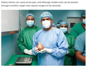 スリランカ在住の男性が今年6月、腎臓結石の摘出手術を受けた。その腎臓結石の大きさ、重さともにギネス世界記録を更新していた（画像は『Guinness World Records　2023年6月15日付「World’s largest and heaviest kidney stone removed from Sri Lankan man」』のスクリーンショット）