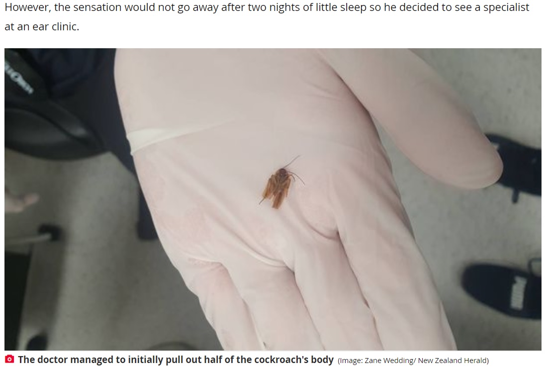 ニュージーランド在住の男性は2022年1月、「耳の中の水が抜けない」と訴えて耳鼻咽喉科へ。医師は耳の中に小さなゴキブリを発見したという（画像は『The Daily Star　2022年1月12日付「Man’s ‘blocked ear’ turns out to have massive cockroach hiding inside」（Image: Zane Wedding/ New Zealand Herald）』のスクリーンショット）