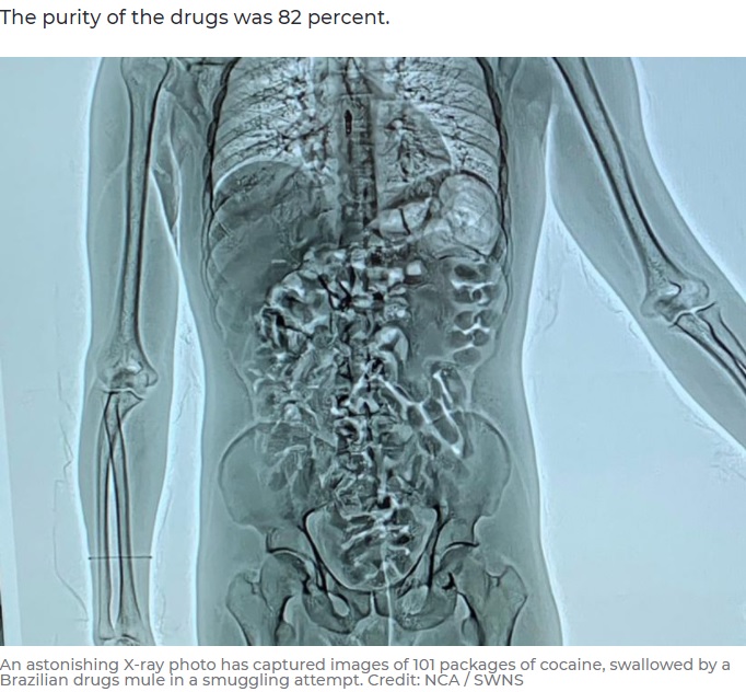 2021年にはブラジルからイギリスまでコカイン101袋を飲み込んだまま運んだ31歳男が逮捕された。消化器官にはびっしりとコカインの小袋が詰め込まれていた（画像は『7NEWS.com.au　2021年2月1日付「Brazilian sex worker swallows 101 cocaine packages in UK drug smuggling stunt」（Credit: NCA / SWNS）』のスクリーンショット）
