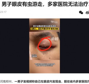 瞼の痙攣が続いていた中国河南省の男性。SNSに動画を投稿し「お勧めの専門医を知っている人はいるかな？」と尋ねていた（画像は『捜狐　2023年2月24日付「可怕！男子眼皮有虫游走，多家医院无法治疗…」』のスクリーンショット）