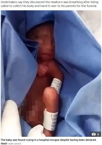メキシコの病院で2020年10月、誕生したものの生命徴候が見られなかったため死産と診断された新生児。6時間後に遺体安置所で泣き声あげて、病院の集中治療室に運ばれたという（画像は『The Sun　2020年10月22日付「LEFT FOR DEAD Miracle moment premature baby born ‘dead’ at 23 weeks is found ALIVE after six hours in morgue refrigerator」（Credit: Canal 13）』のスクリーンショット）