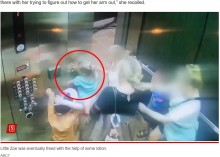【海外発！Breaking News】エレベーターの戸袋に腕を引き込まれた5歳少女、20針縫う大ケガ（米）＜動画あり＞