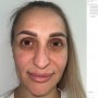 【海外発！Breaking News】トルコで美容整形した女性、スーパーモデルのような顔に「変わりすぎて怖い」「新しいパスポートが必要」の声