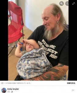 生前のジェレミーさん。生え際が馬蹄形のような形をしていた（『Emily Snyder　Facebook「My husband passed away on August 18th, 2021.」』より）