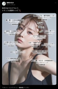 顔のパーツごとに整形内容を写真で明かした福岡みなみ（『福岡みなみ　X「来世分までモテちゃう」』より）